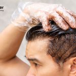 Cara Mudah Menghilangkan Bleaching Rambut yang Wajib Diketahui