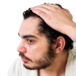 Penyebab Garis Rambut Mundur dan Cara Mengatasinya