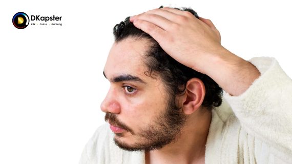 Penyebab Garis Rambut Mundur dan Cara Mengatasinya