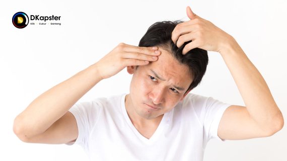5 Penyebab Jerawat di Kepala dan di Punggung dan Cara Mengatasinya
