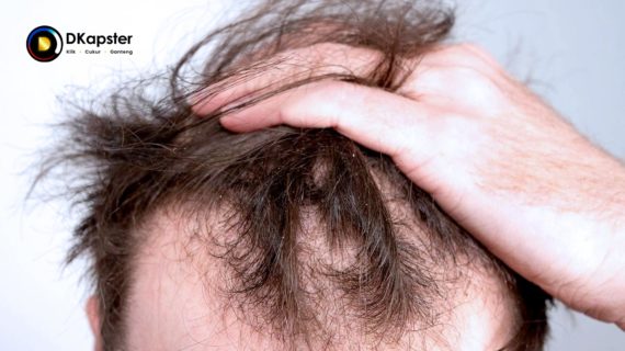 15 Penyebab Rambut Patah dan Cara Mengatasinya
