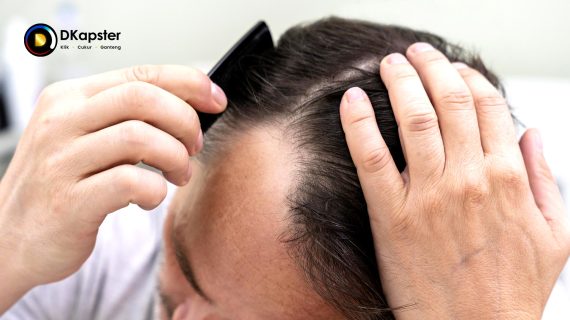 Rambut Rontok Karena Stress? Yuk Ketahui Cara Mengatasinya