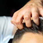 Mengenal Folikel Rambut dan Cara Menumbuhkan Rambut yang Kuat