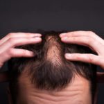 10 Mitos Rambut yang Perlu Diketahui