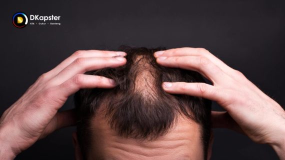 10 Mitos Rambut yang Perlu Diketahui