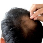 10 Kesalahan Perawatan Rambut Pria yang Sering Dilakukan